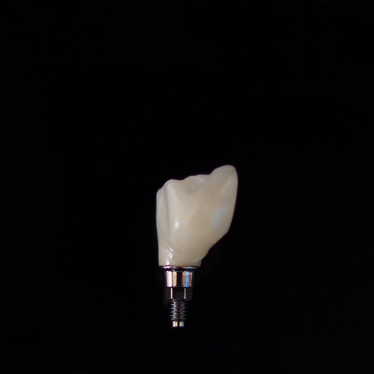 Quels sont les différents types d’implants dentaires et comment choisir